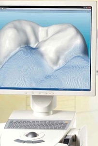 cerec-blue-cam